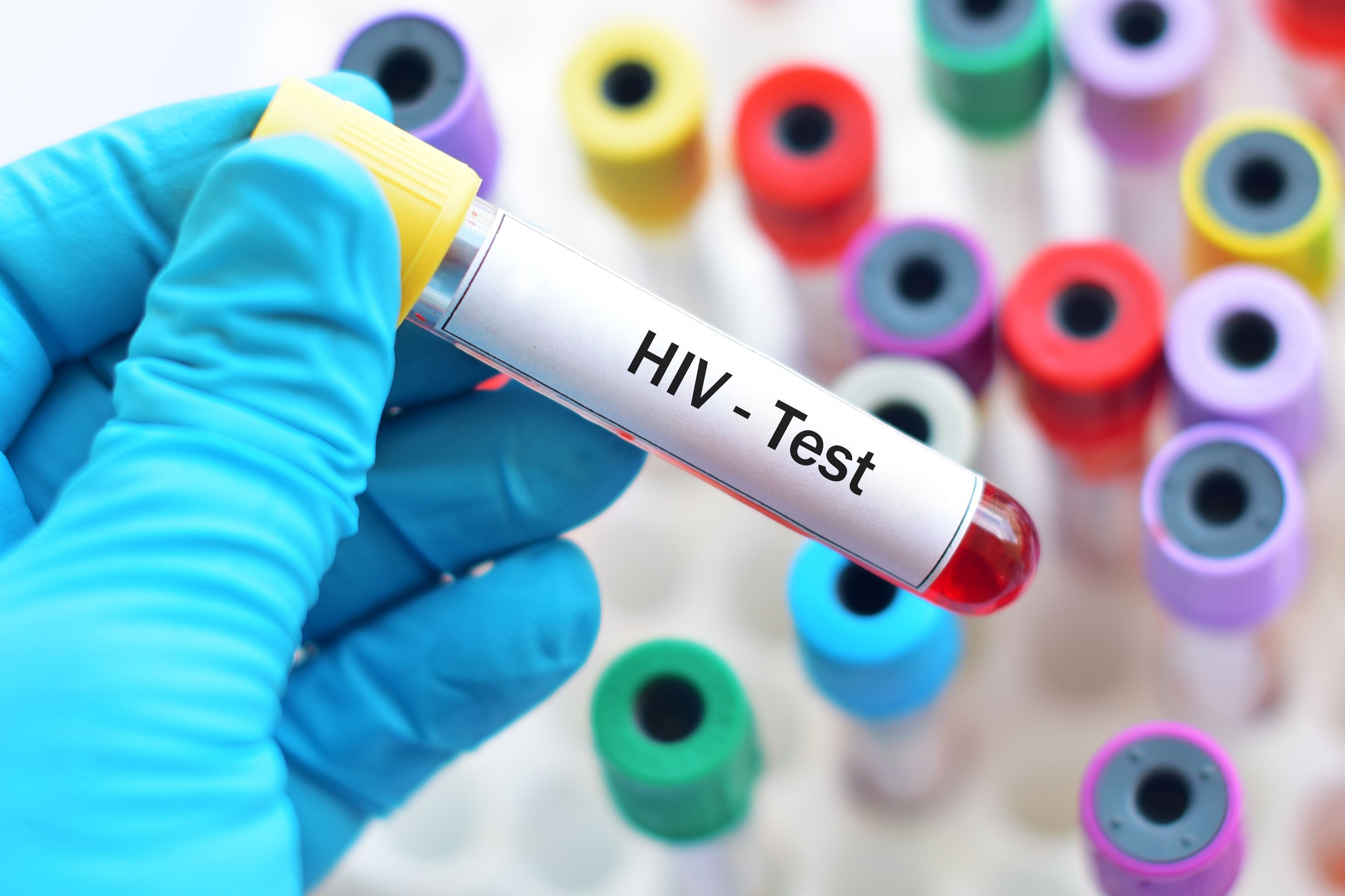 HIV test | Image credit: jarun011 - stock.adobe.com