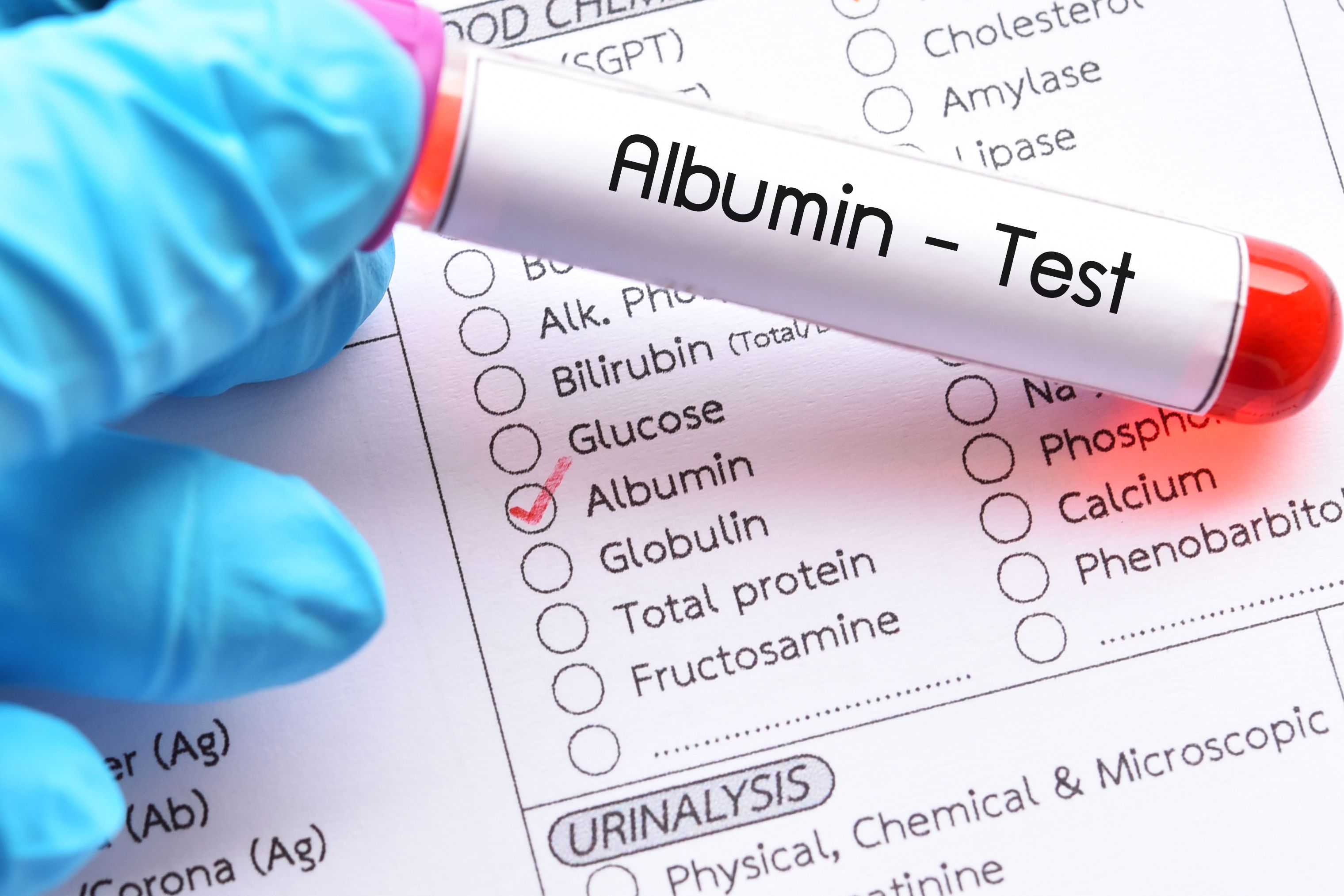 Albumin is the most abundant protein in the blood | image credit: jarun011 - stock.adobe.com