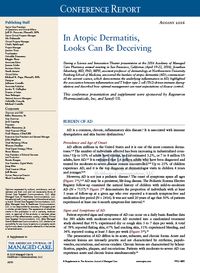 In Atopic Dermatitis, Looks Can Be Deceiving