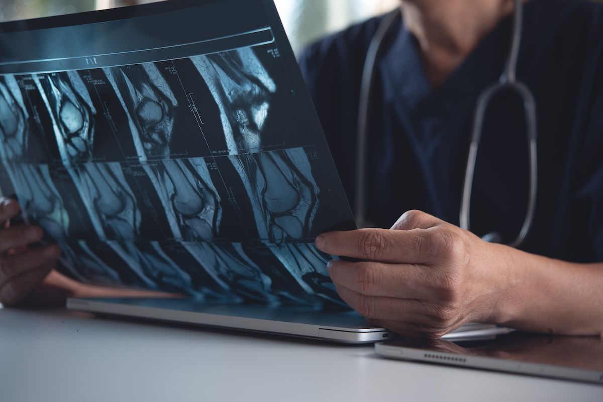 Musculoskeletal Quality Collaborative Improves Value-Based Health Care Delivery Across Hospital System