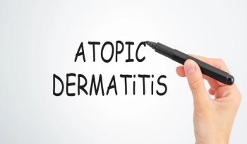 atopicdermatitis | Image Credit: © Pawel-stock.adobe.com