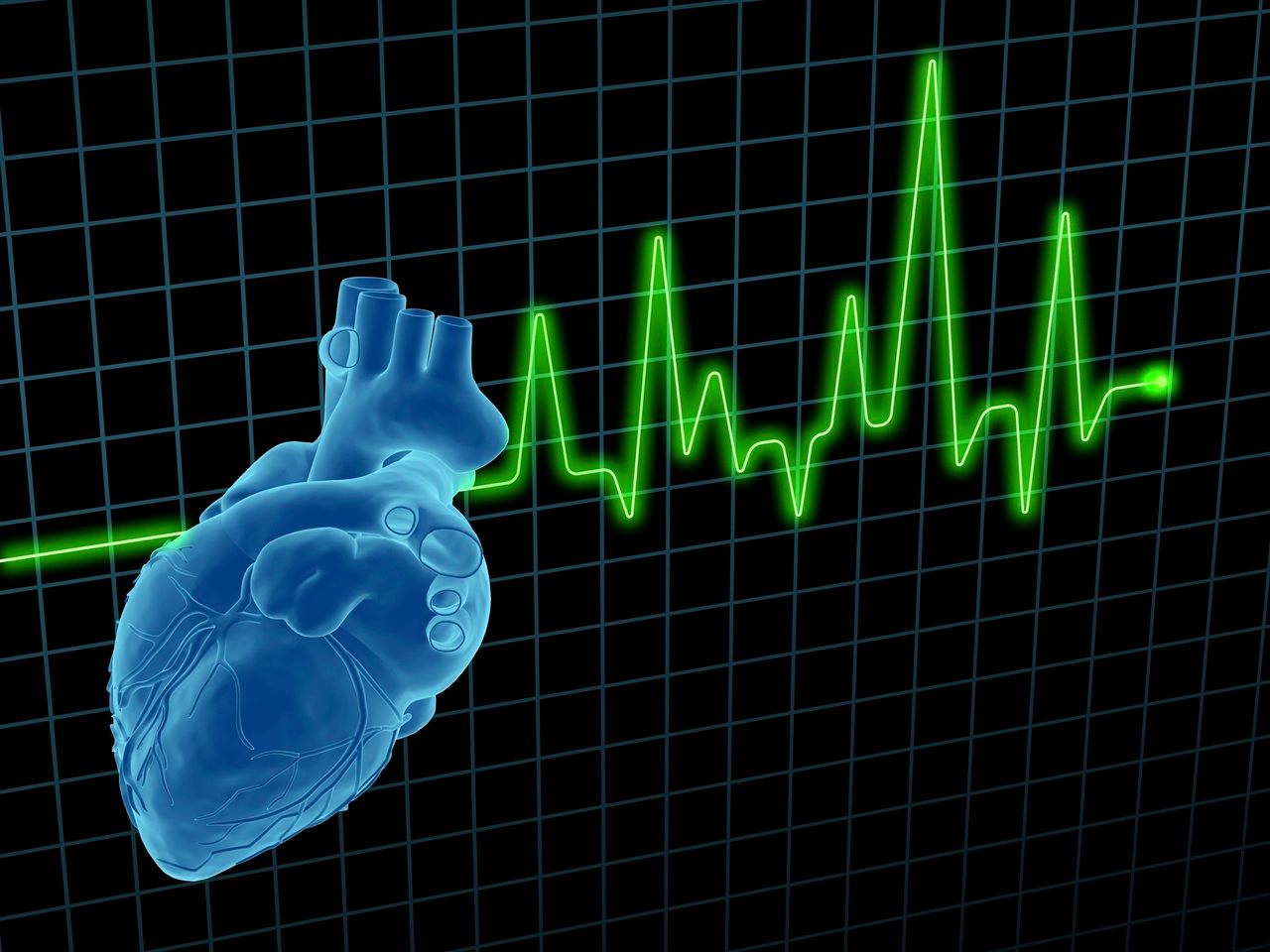 Canagliflozin Conveys Lower Risk of Adverse CV Events in Patients With High CV Risk, T2D