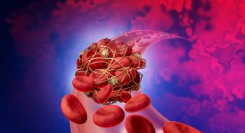 Thrombosis | Image Credit: freshidea - stock.adobe.com