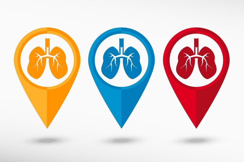 Potential Molecular Mechanisms That Increase COVID-19 Risk in Lung Cancer Highlighted – AJMC.com Managed Markets Network Potential Molecular Mechanisms That Increase COVID-19 Risk in Lung Cancer Highlighted – AJMC.com Managed Markets Network