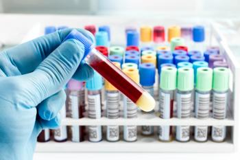Test tubes in a lab