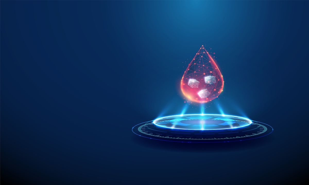 Glucose monitoring | Image Credit: © Елена Бутусова-stock.adobe.com
