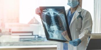nerandomilast in IPF, ILD lung conditions | Image credit: Chinnapong - stock.adobe.com