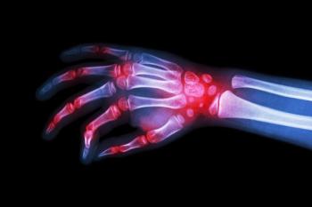 RA Xray Concept | image credit: stockdevil -stocke.adobe.com