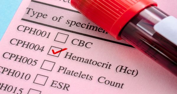 Hematocrit | Image Credit: © gamjai - stock.adobe.com