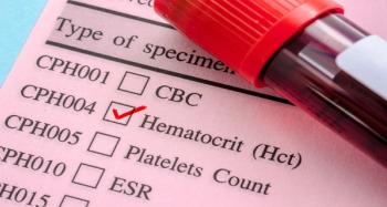 Hematocrit | Image Credit: © gamjai - stock.adobe.com