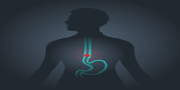 Enhanced image of an esophagus
