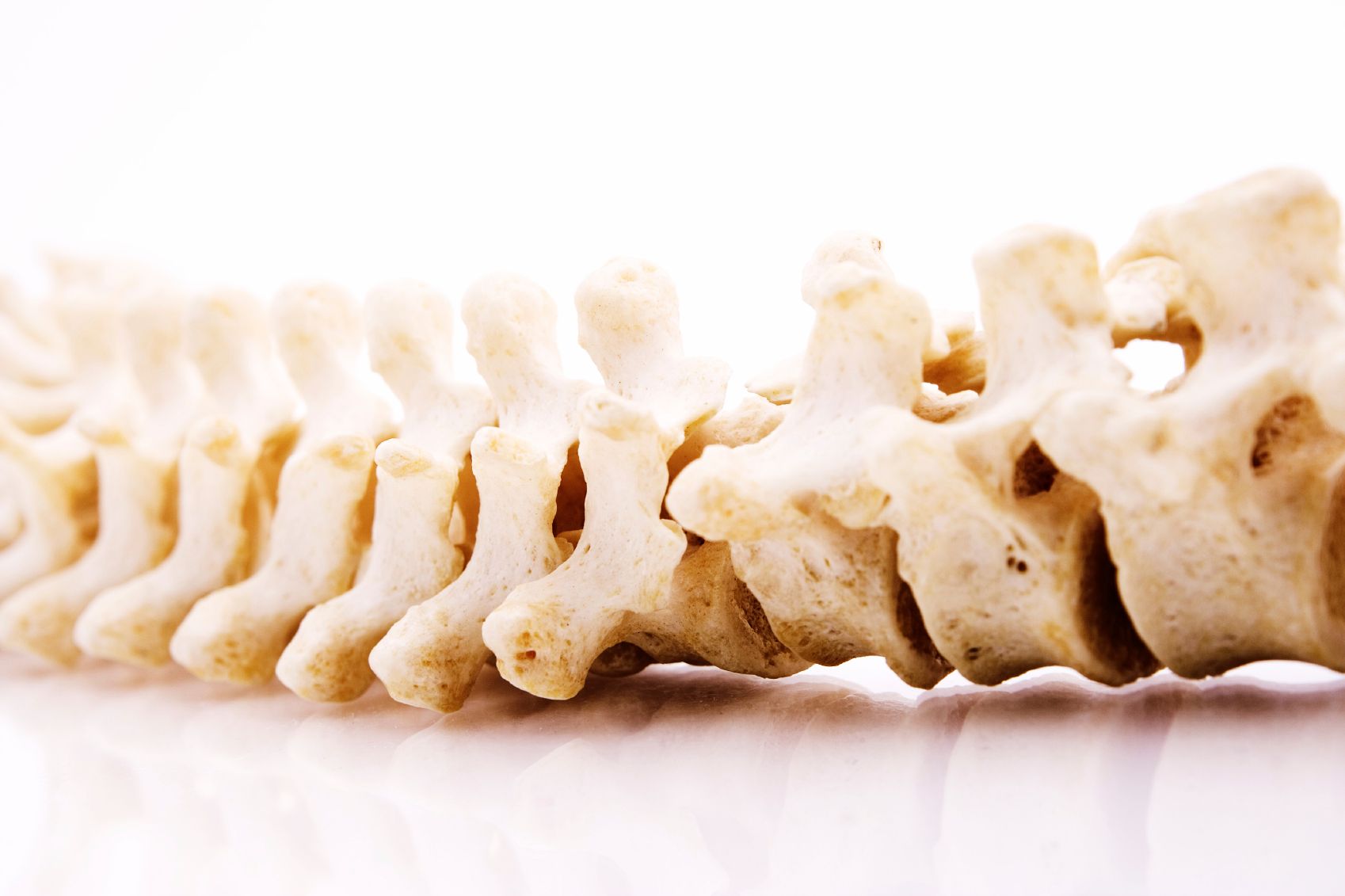 Psa Back Pulling Apart Methods of Diagnosing Axial Psoriatic Arthritis, Back Pain