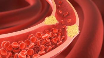 High cholesterol | Image credit: Anusorn - stock.adobe.com