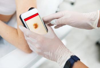 AI application scanning mole | Image Credit: Taras Grebinets - stock.adobe.com