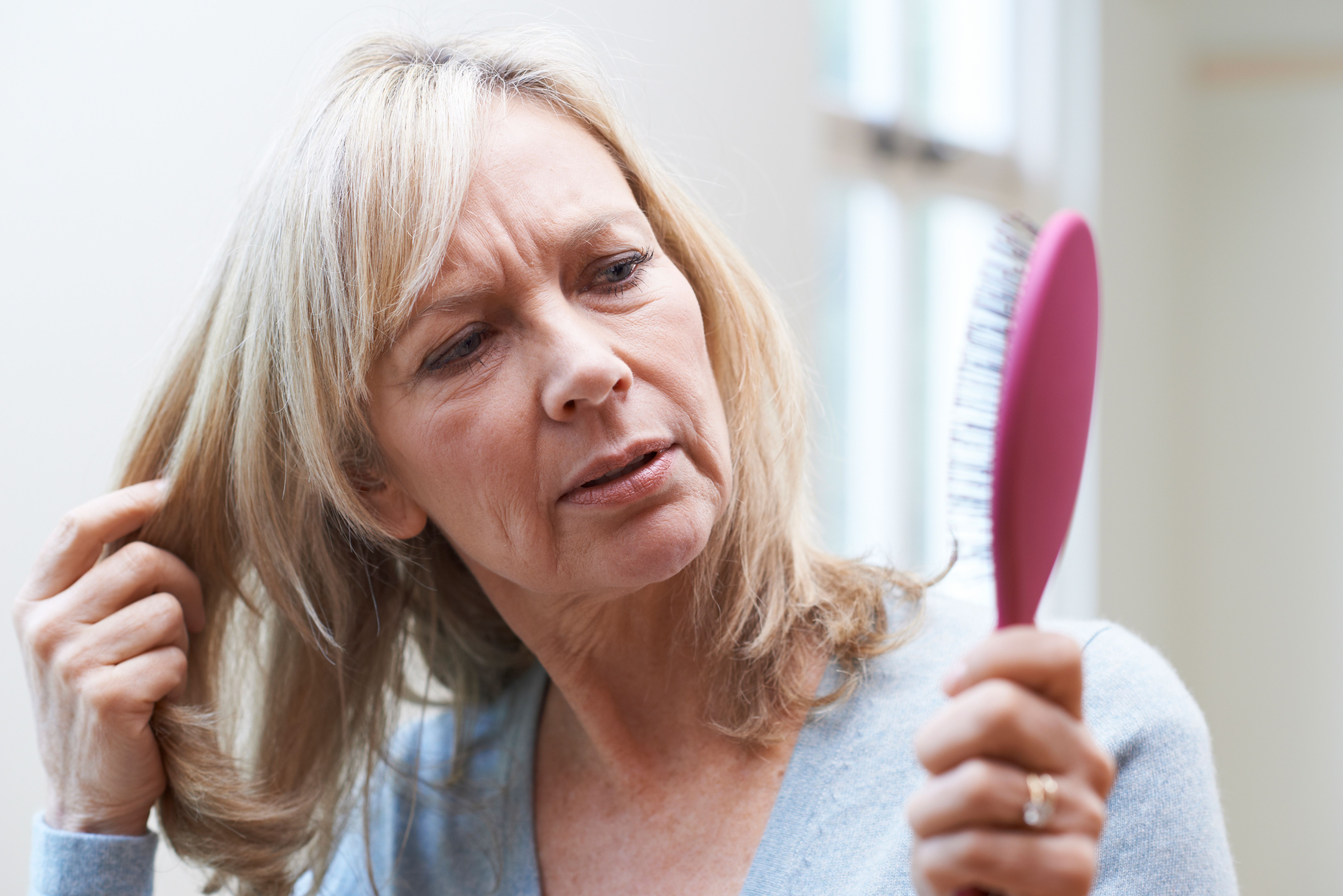 Mature woman with alopecia. | Image Credit: highwaystarz - stock.adobe.com