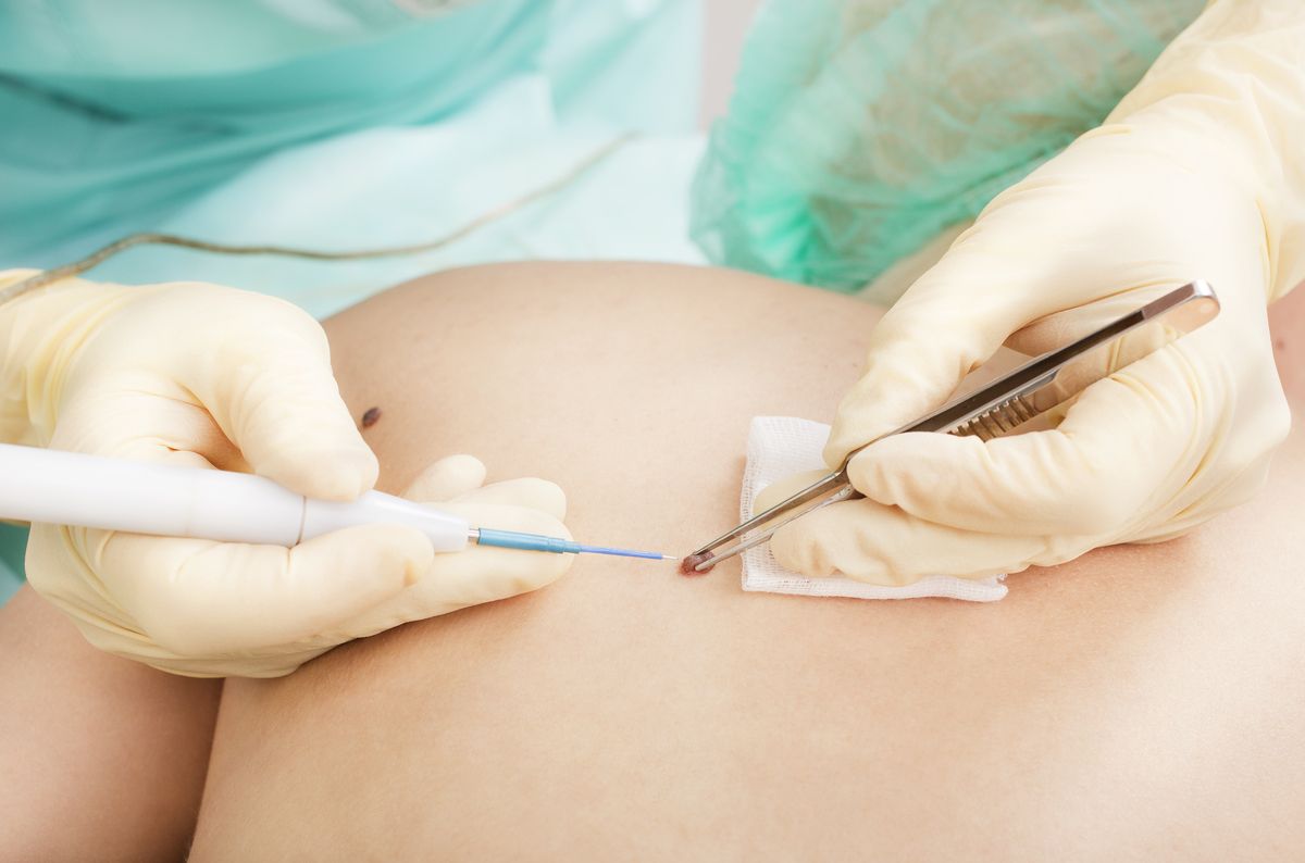 Image of examination for skin cancer