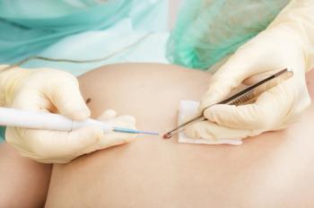 Image of examination for skin cancer