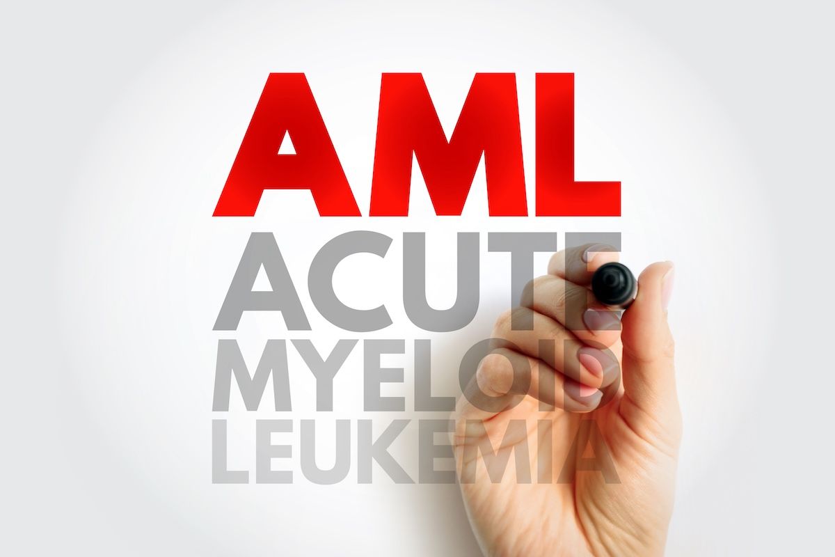AML graphic | Image Credit: © dizain-stock.adobe.com
