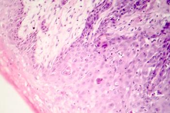 CSCC | Image Credit: Dr_Microbe - stock.adobe.com