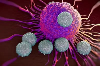 Cases Show How Epcoritamab Revived CAR T Cells After Relapse in DLBCL