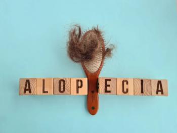 Hair loss on brush with AA text. | Image Credit: Nadzeya- stock.adobe.com