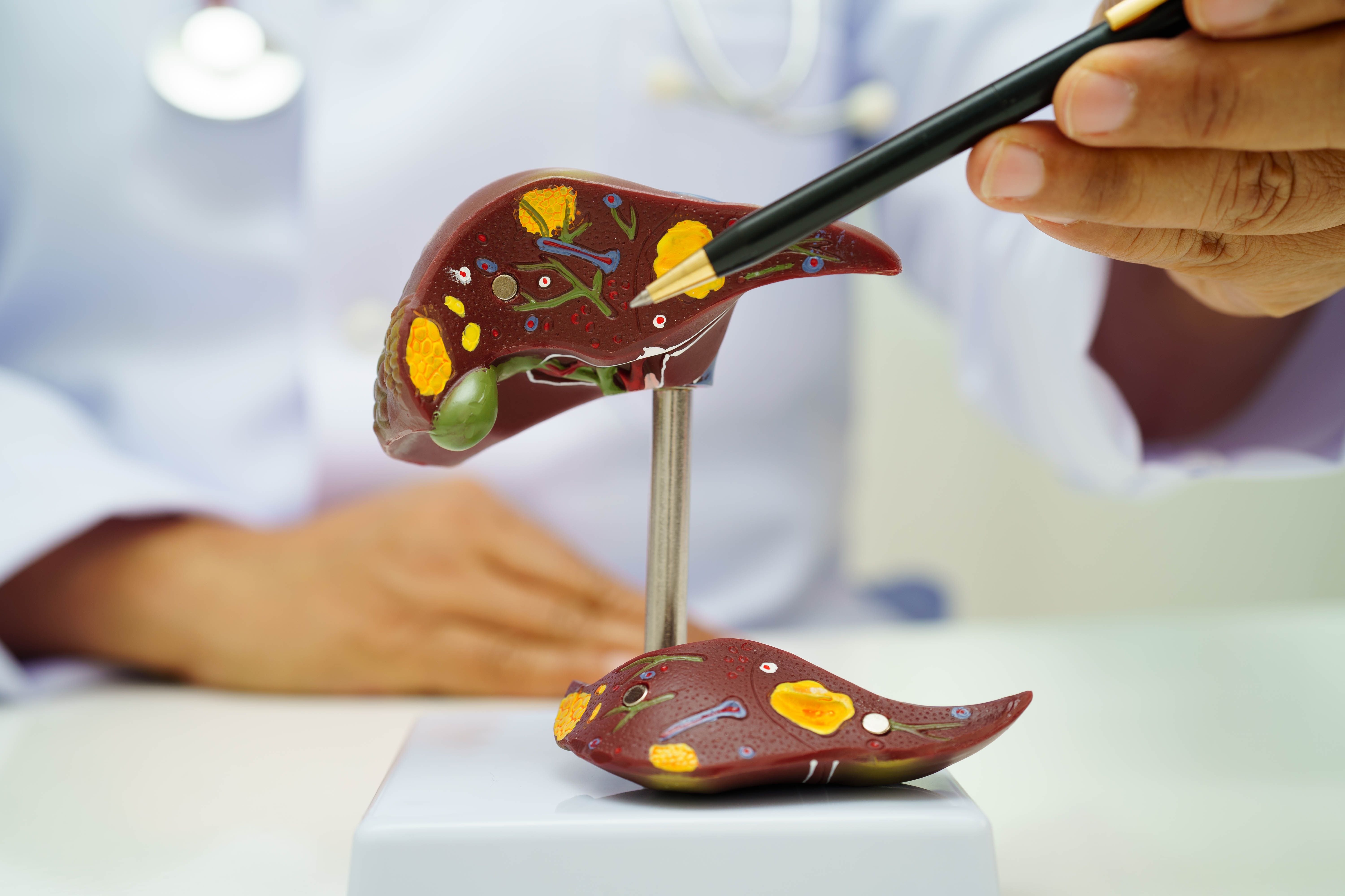 Doctor pointing to liver fibrosis model | Image credit: Pakawadee – stock.adobe.com