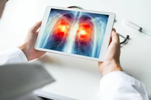 Doctor looking at x-ray on tablet | Image credit: steph photographies - stock.adobe.com