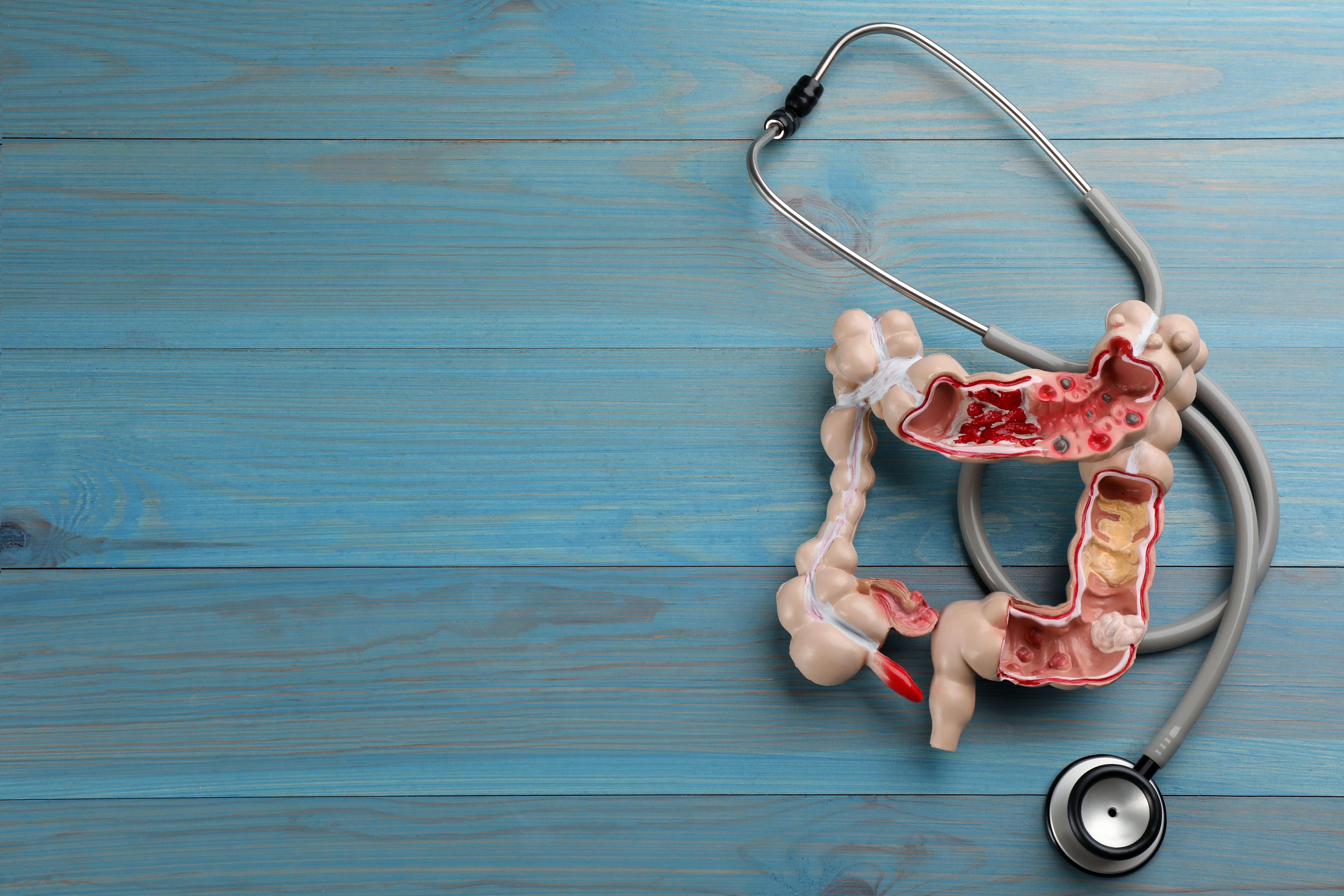 Colon | Image credit: New Africa - stock.adobe.com