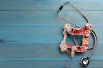 Colon | Image credit: New Africa - stock.adobe.com
