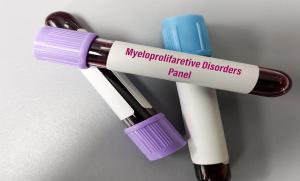 Beyond its clinical implications, the study contributes to a deeper understanding of how hematologic malignancies evolve under selective pressure. | Image credit: MdBabul-stock.adobe.com