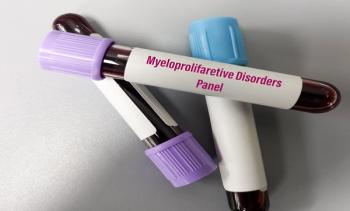 Multi-hit TP53 mutations are a significant negative prognostic factor for patients with both MPN and AML, the new study found. | Image credit: MdBabul - stock.adobe.com