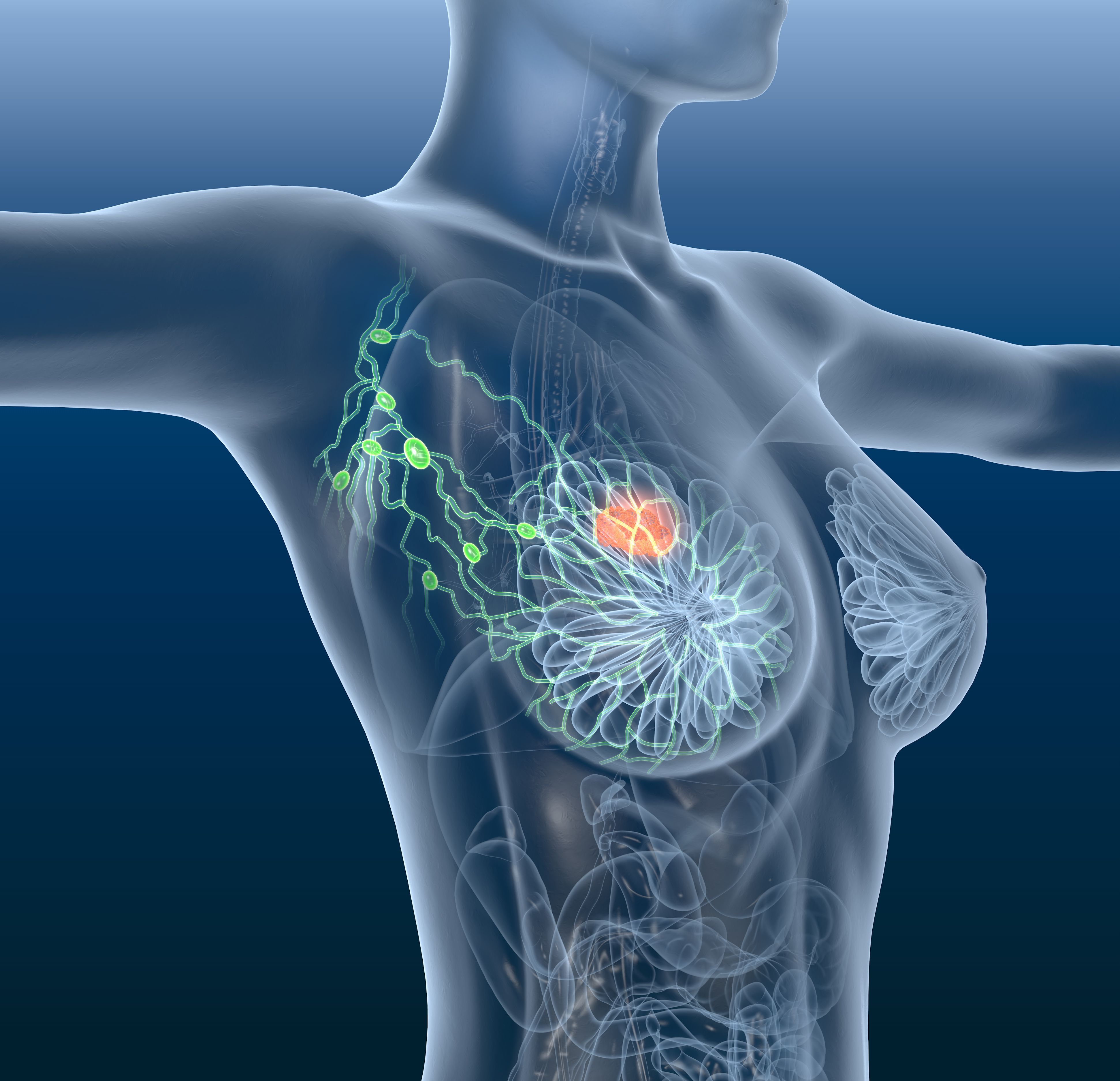 El estudio indica que la resonancia magnética es el mejor método para detectar el cáncer de mama en mamas de alta densidad