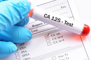 CA-125 test | Image Credit: jarun011 - stock.adobe.com