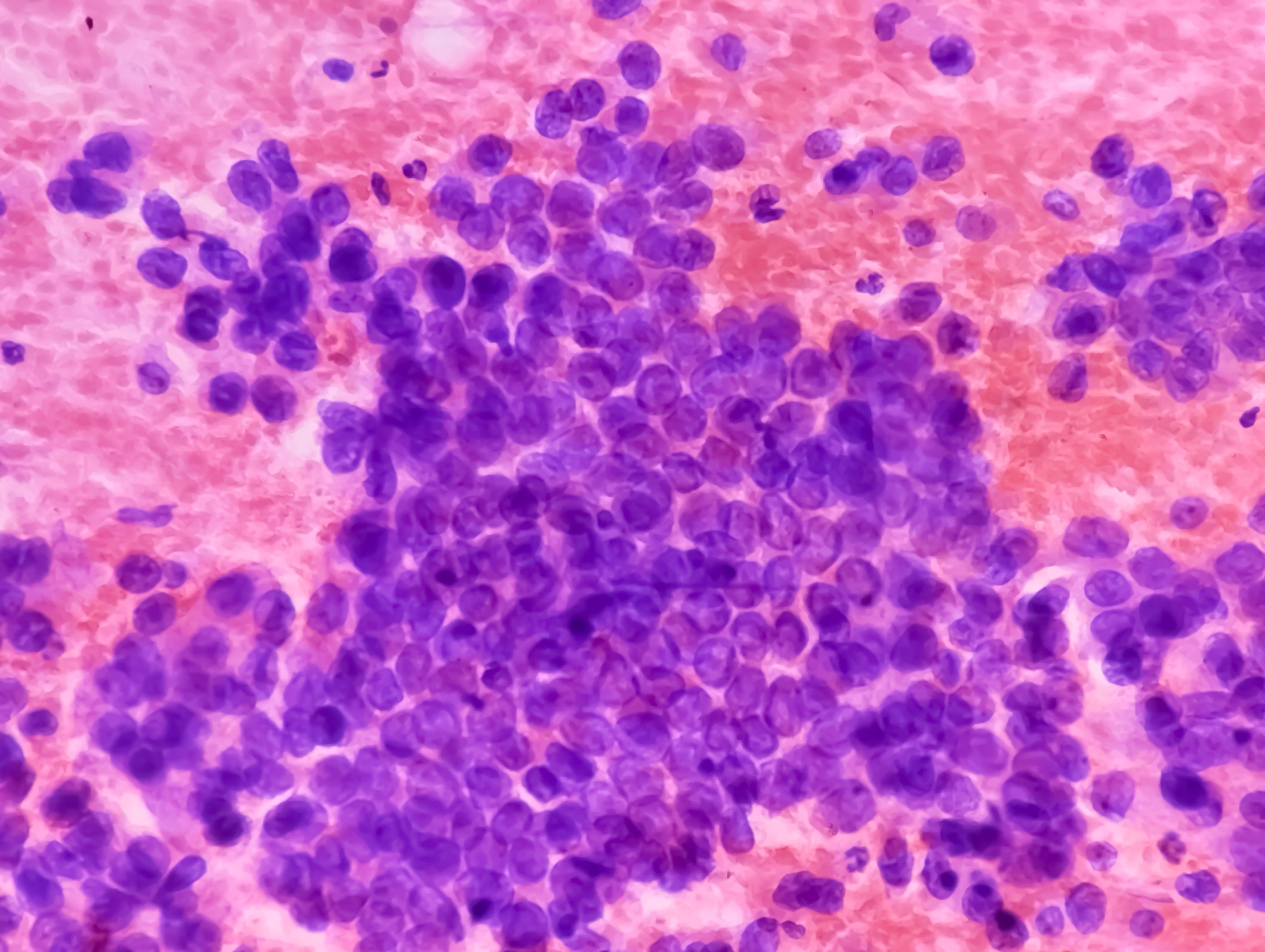 Clinical Advances in EGFR-Mutated NSCLC: Insights From MARIPOSA and FLAURA2