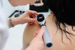 Scientists Discover Gene That May Cause Melanoma to Metastasize