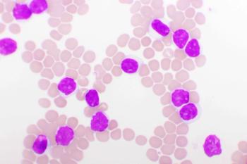 The overall response rate with first-line zanubrutinib for CLL reached 97.3%, with 18.2% of patients experiencing complete response or complete response with incomplete hematologic recovery. | Image Credit: jarun011 - stock.adobe.com