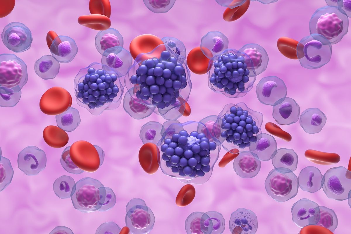 dlbcl | Image Credit: laszlo-stock.adobe.com