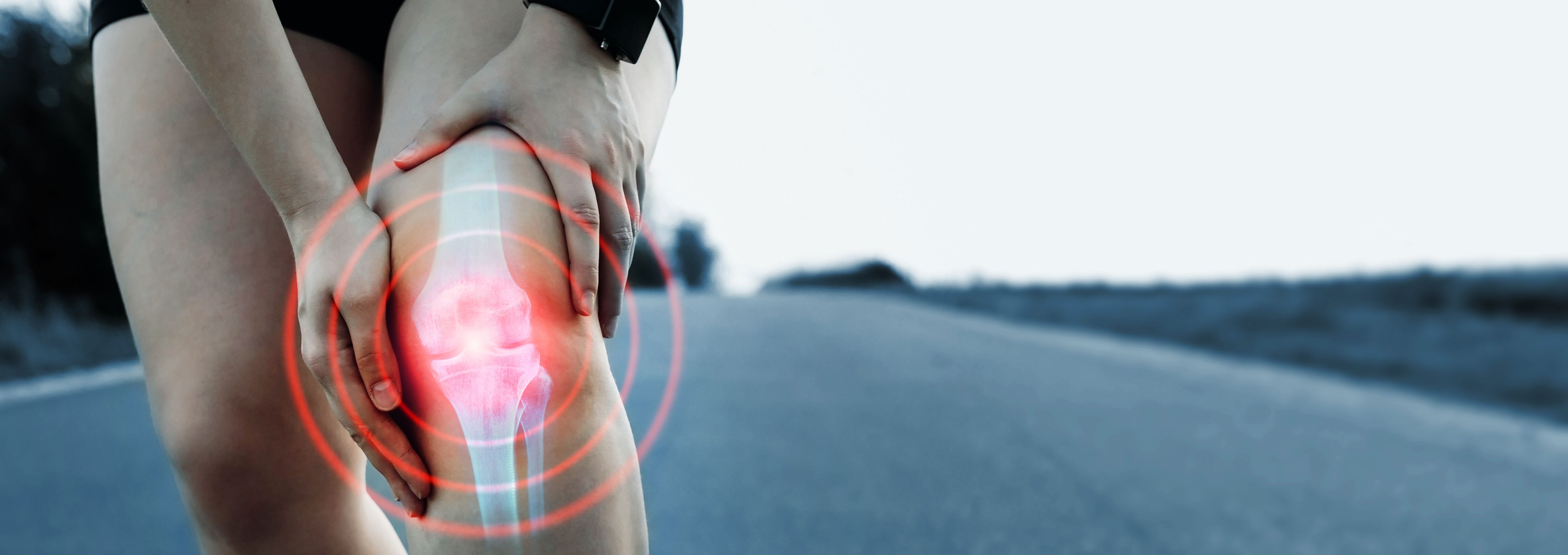 Tirzepatide is more cost-effective than semaglutide for patients with obesity and osteoarthritis. | Image Credit: @Miha Creative-AdobeStock.jpeg