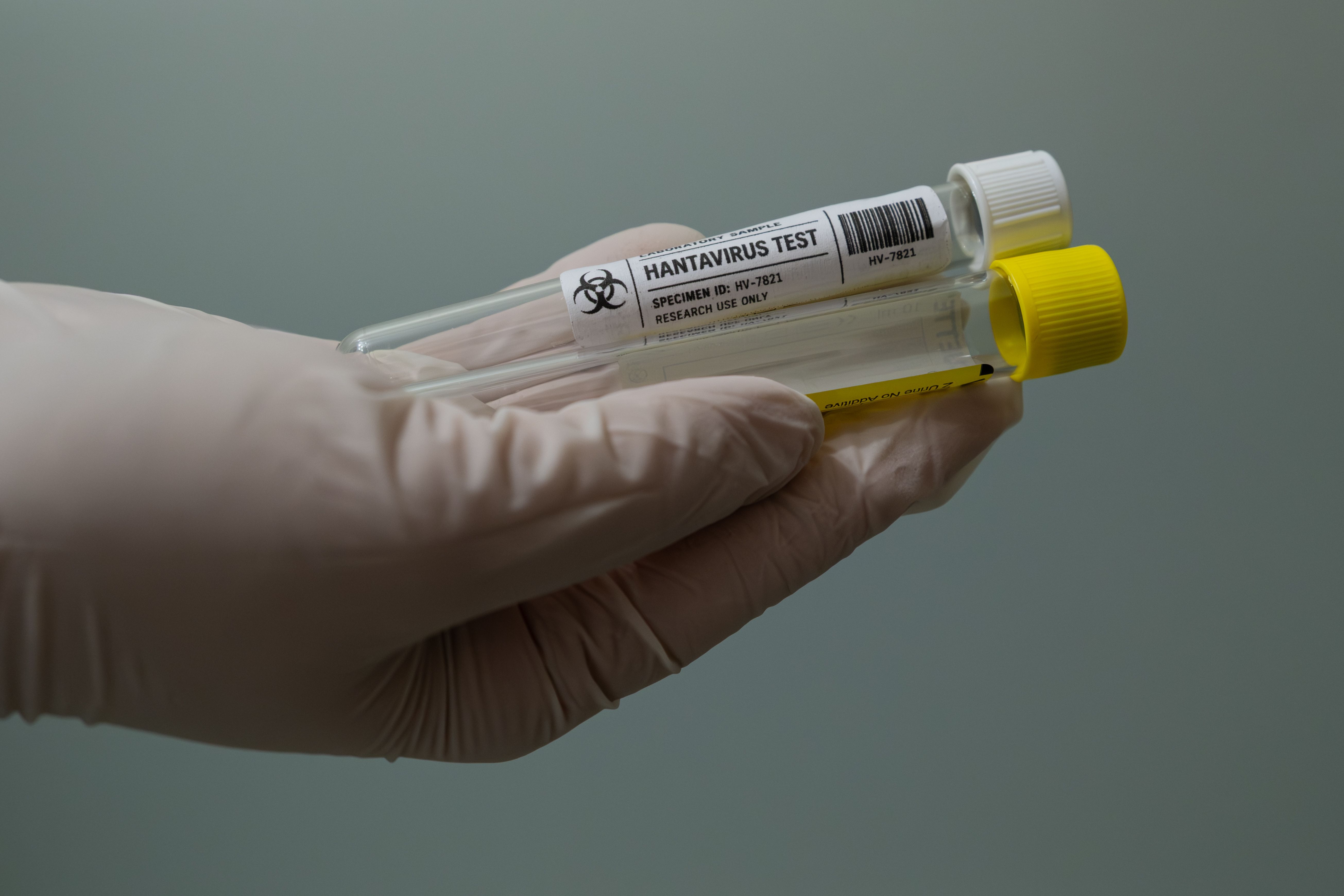 Hantavirus test | Image credit: Luis Martinez T - stock.adobe.com