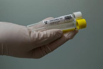 Hantavirus test | Image credit: Luis Martinez T - stock.adobe.com