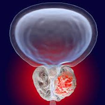 prostate cancer | Image: Dr Microbe Adobe