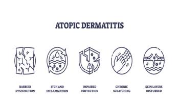 Atopic dermatitis  | Image Credit: © VectorMine-stock.adobe.com.