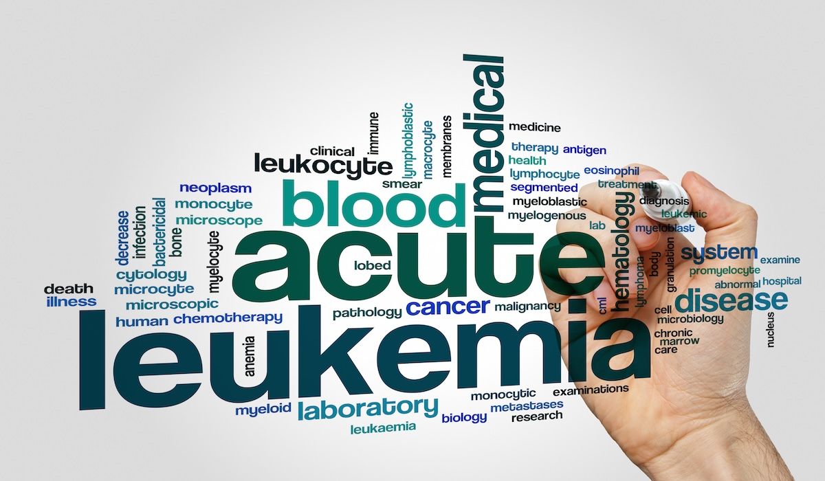 Venetoclax Combinations Show Promise Across ALL/AML