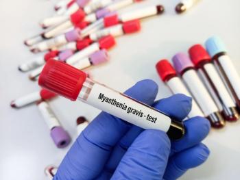 Laboratory test tubes with blood for myasthenia gravis test, diagnosis of myasthenia gravis disease, focus view: © MdBabul - stock.adobe.com