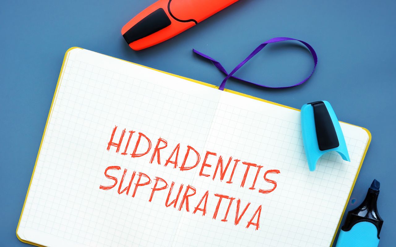 Financial concept meaning Hidradenitis Suppurativa with phrase on the page: © Yurii Kibalnik - stock.adobe.com