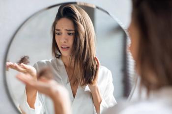 Woman worried about hair loss | Image Credit: Prostock-studio - stock.adobe.com