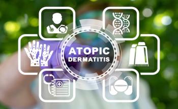 atopic dermatitis | Image Credit: © wladimir1804-stock.adobe.com