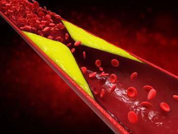 Left bundle branch block may be an significant indicator of heart failure succeeding previous risk-factors like diabetes and hypertension. | Image Credit: AdobeStock_phonlamaiphoto.jpeg