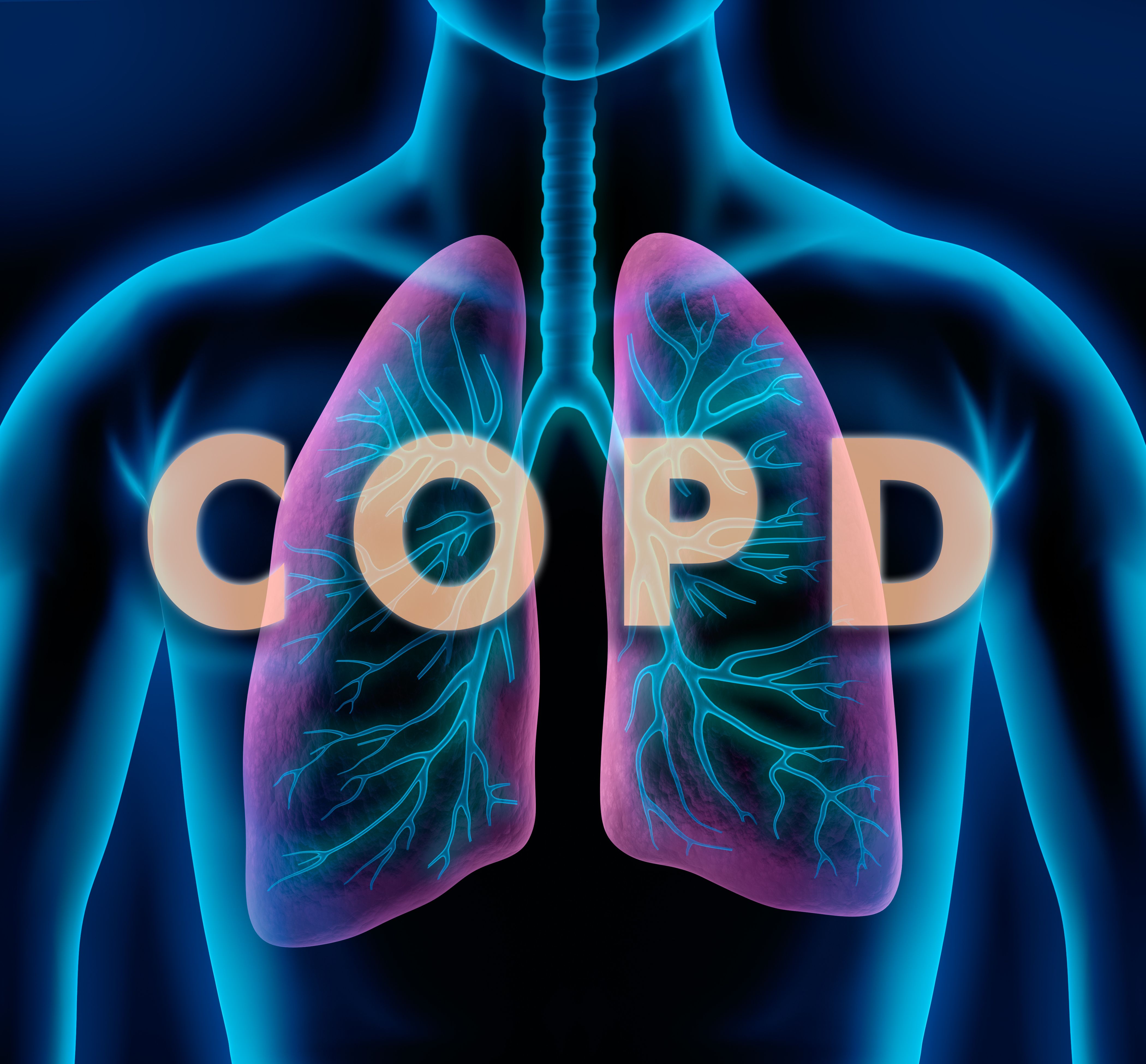 Un SII alto se asocia con un aumento de la insuficiencia respiratoria y el riesgo de muerte en pacientes con EPOC