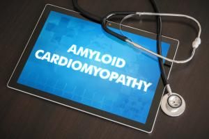 Tablet saying amyloid cardiomyopathy. | Image credit: ibreakstock – stock.adobe.com